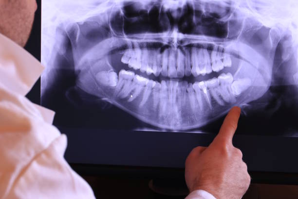 Best Emergency Treatment for Oral Infections in Minot, ND