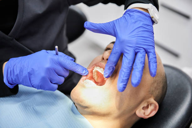 Best Emergency Wisdom Tooth Extraction in Minot, ND